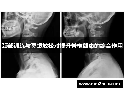 颈部训练与冥想放松对提升脊椎健康的综合作用